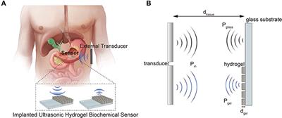 A Hydrogel-Based Ultrasonic Backscattering Wireless Biochemical Sensing